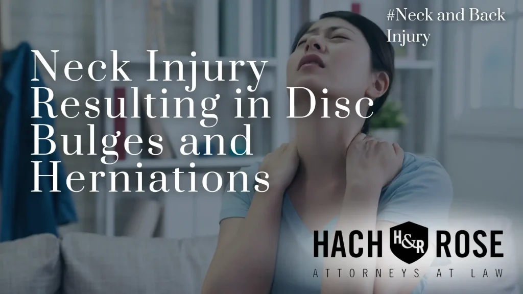 Neck Injury Resulting in Disc Bulges and Herniations Image