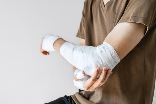 person with a heavily bandaged arm gently supporting the injury